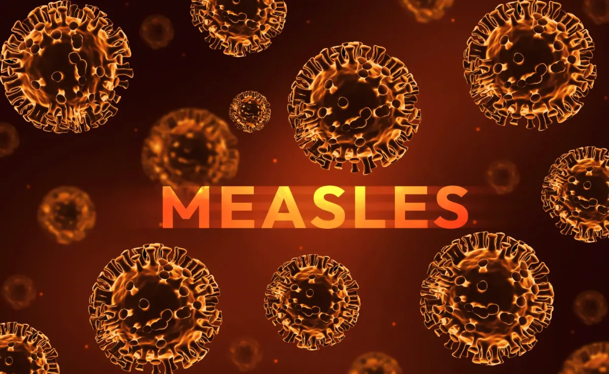 Measles-Is-Spreading-Again