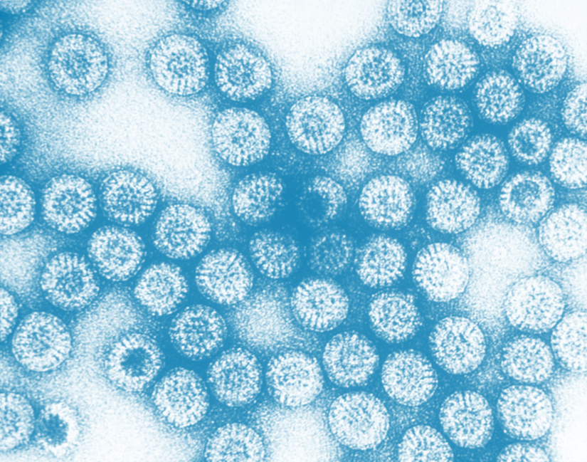 Transmission electron microscopic image of rotavirus Transmission electron microscopic image of rotavirus